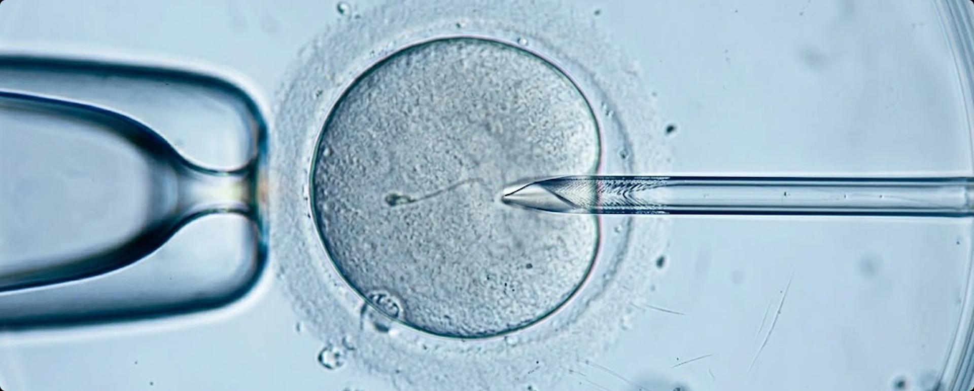An egg being fertilised in a lab during IVF