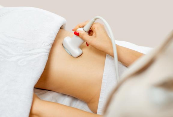 A woman getting a transabdominal scan