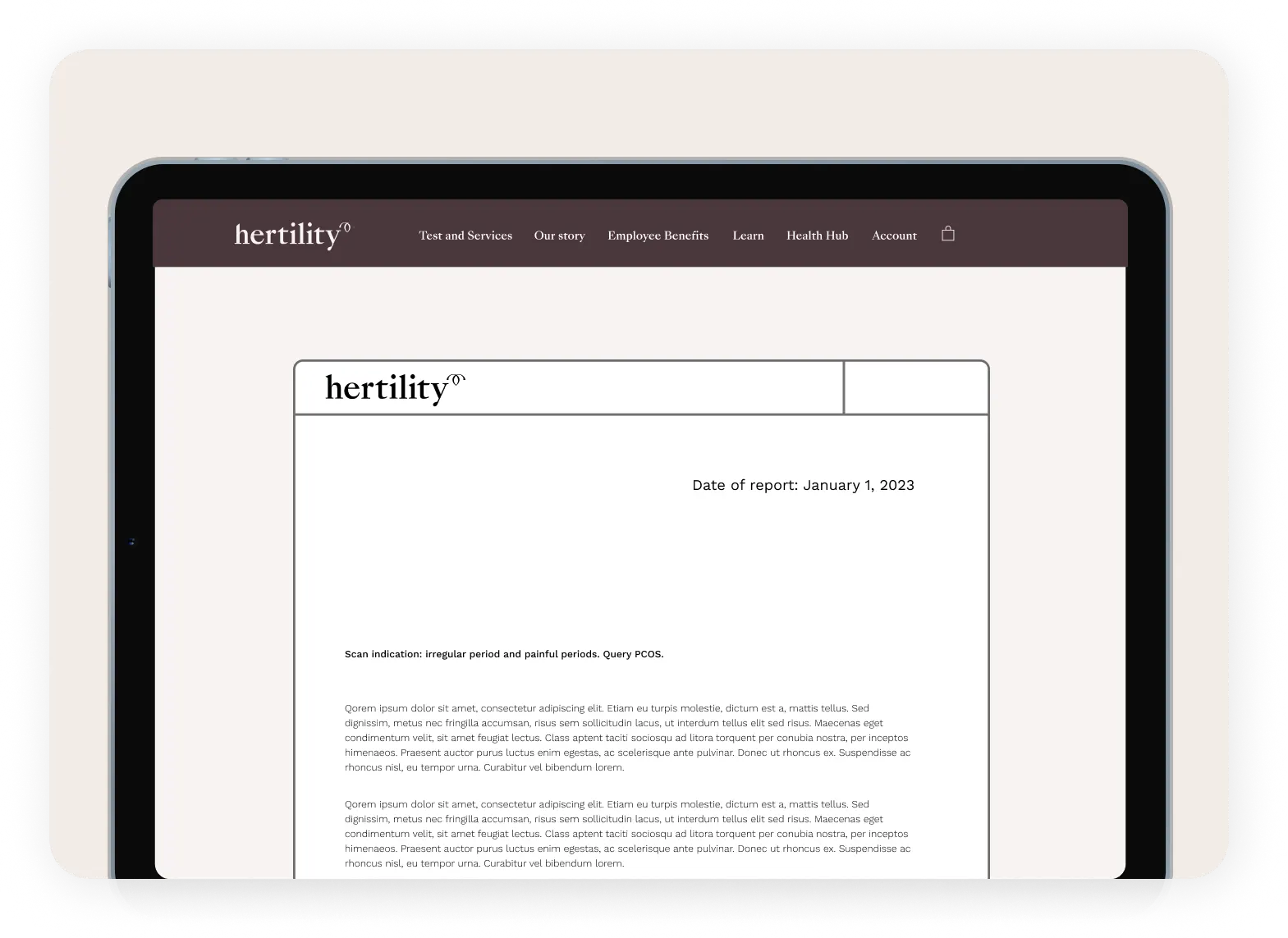 Step-by step guidance to fertility treatments