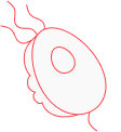 Trichomoniasis